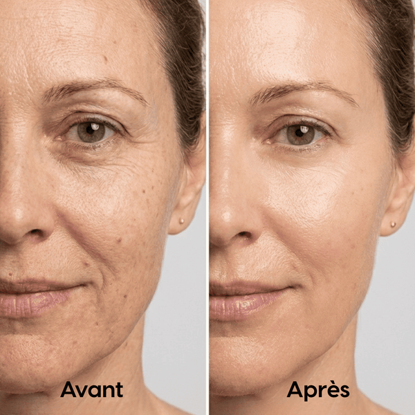 Crème Hydratante alternative au Rétinol